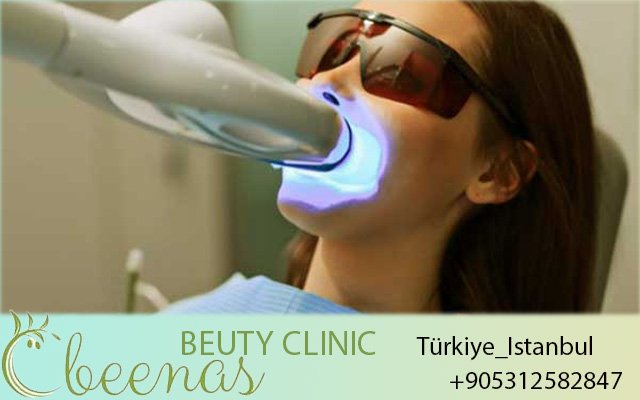 Reviews Dental Implants Turkey 2026