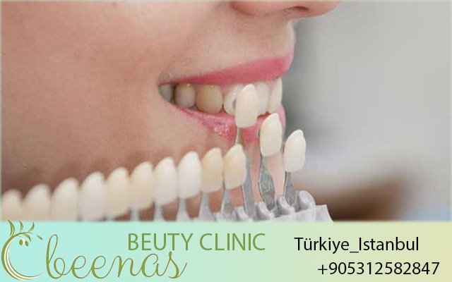 Laviva Clinic – Best Dental Clinic in Turkey 2026