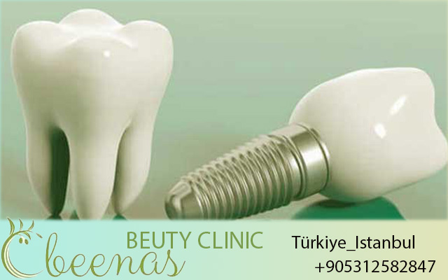 Oral Health Services in Turkey 2026