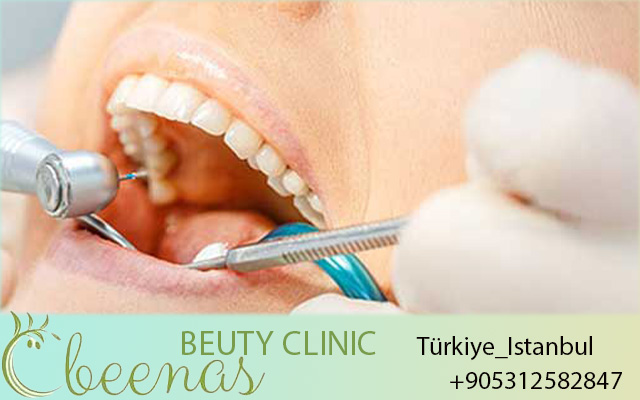 Dentist in Istanbul