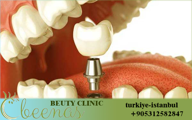 Top 10 Dentist in Istanbul