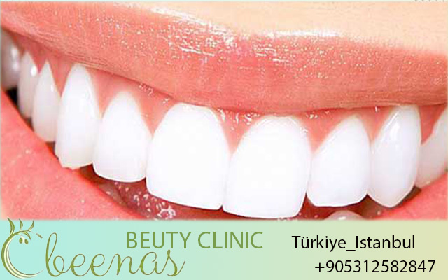 Best Dental Implants in Turkey 2026