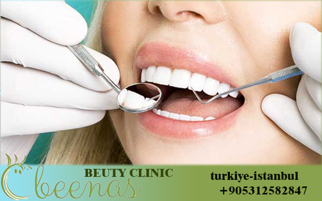 Dental Veneers in Turkey 2026