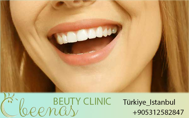 All on 4 Dental Implants Turkey 2026