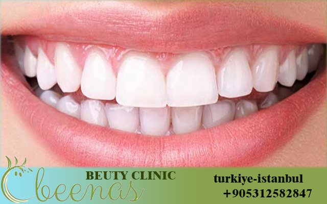 Dental Implant Clinics in Turkey 2026