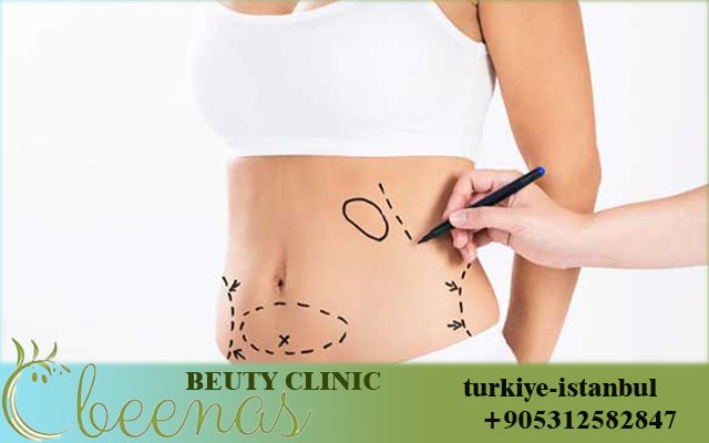Body Sculpting in Turkey: 17 Powerful Reasons to Transform Your Body in 2026 ⭐⭐⭐⭐⭐ (5/5)