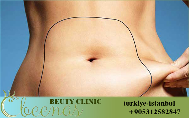 coolsculpting cost belly in Turkey