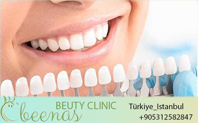 How to Find a Good Dentist in Turkey 2026