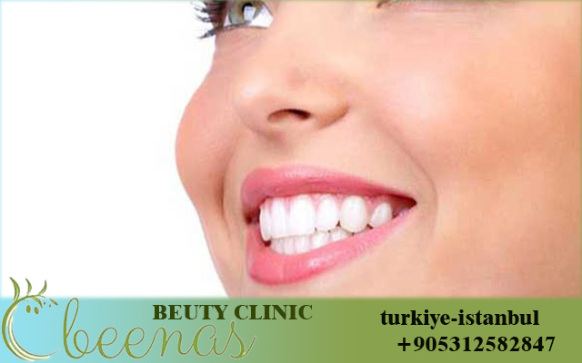 sevil smile studio turkey price list