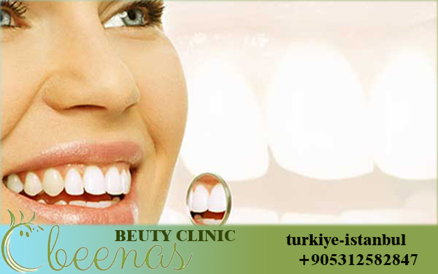 Dental Care in Turkey