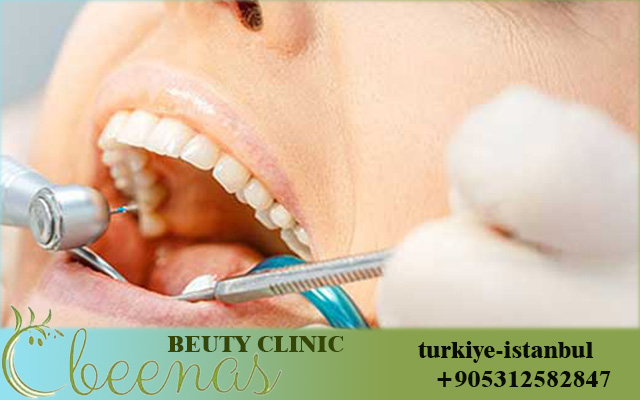 Dental clinics in Turkey