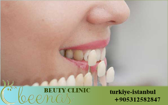 Best dentist in Turkey