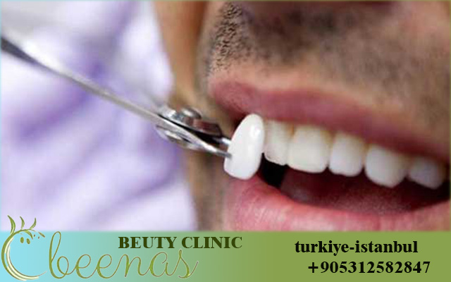 Best dental clinic in Istanbul