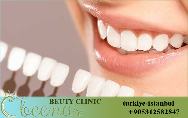 Dental Treatment in Istanbul