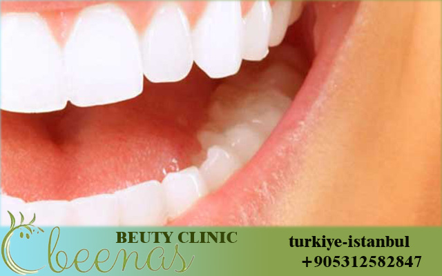 Best dental implants in Turkey